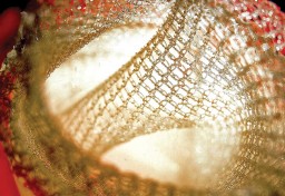 The types of fibres and fabrics normally used in biomedical applications are non-resorbable fibres. It offers four textile technology platforms like braiding; weaving; knitting; and nonwovens. All of these platforms are expandable based on the requirements of the application.